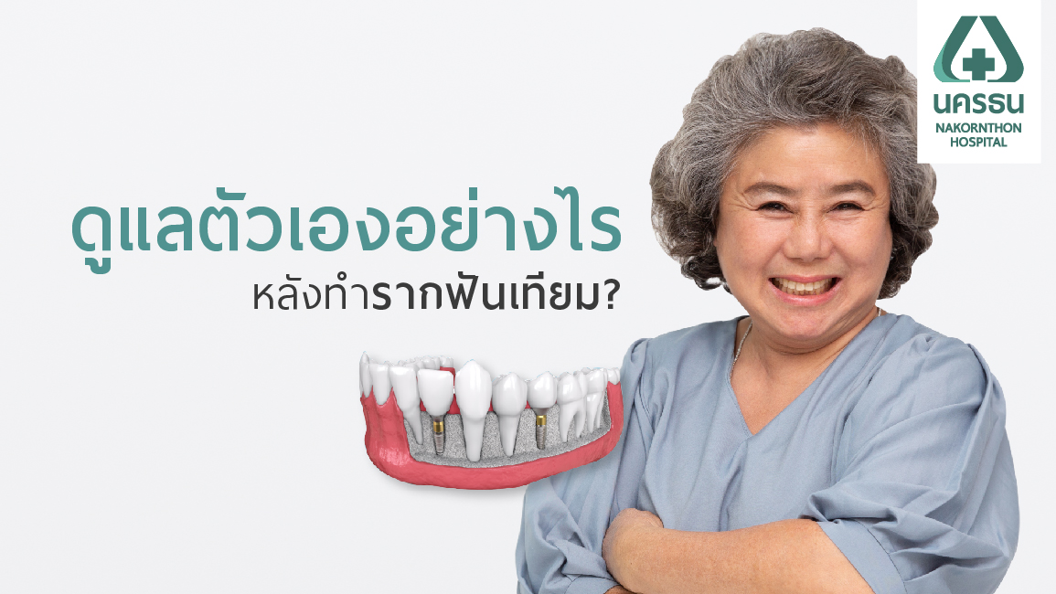 การปฏิบัติตัวหลังใส่รากฟันเทียม ให้มีอายุใช้งานยืนยาวได้อย่างที่สุด